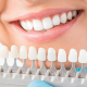 Cosmetic Dental Practices Alanya