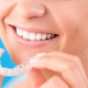 Wireless Orthodontics - Transparent Plaque: Wireless Teeth Correction, Invisalign Practices